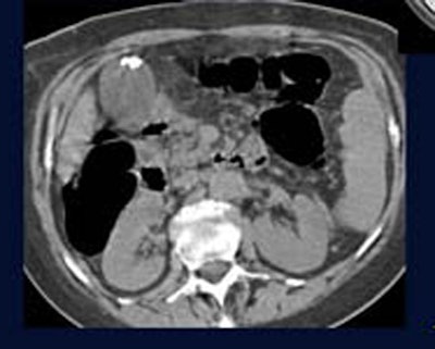 2005 08 16 15 25 50 706