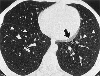 2005 08 24 14 28 28 706