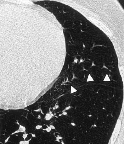 2005 08 24 14 29 55 706