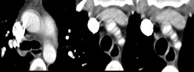 2005 08 24 14 34 05 706