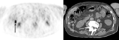 2005 09 06 11 23 45 706