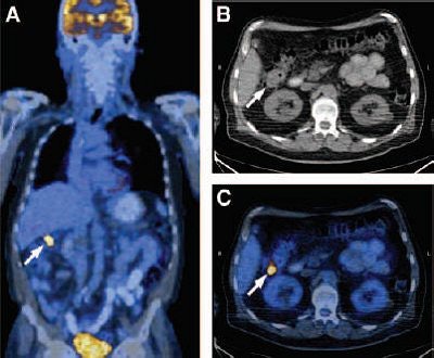 2005 09 06 11 26 16 706