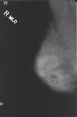 2005 09 16 10 40 27 706