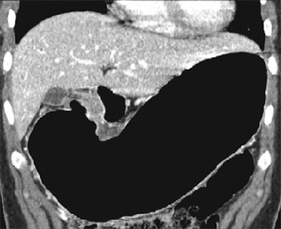 2005 09 23 15 08 39 706