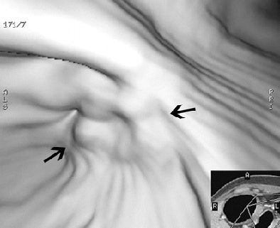 2005 09 23 15 09 01 706