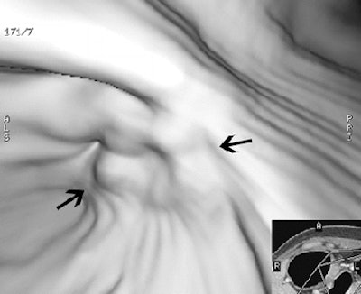 2005 09 23 15 09 01 706