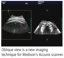 2005 11 08 15 33 25 706