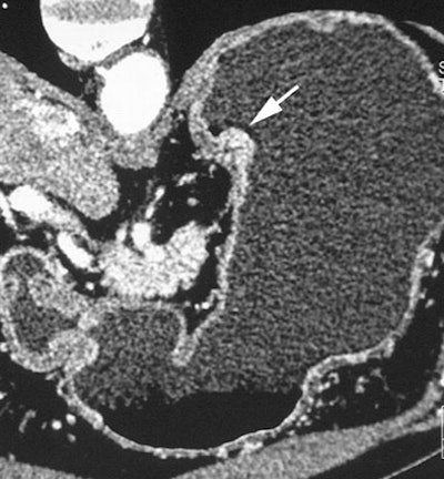 2005 11 11 20 15 45 706