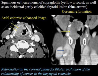 2005 11 14 00 40 14 706