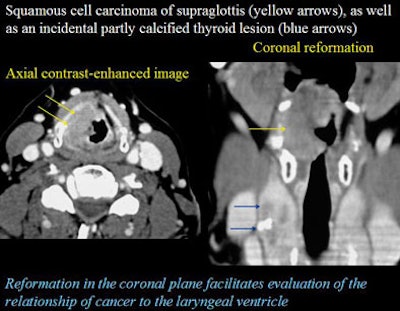 2005 11 14 00 40 14 706