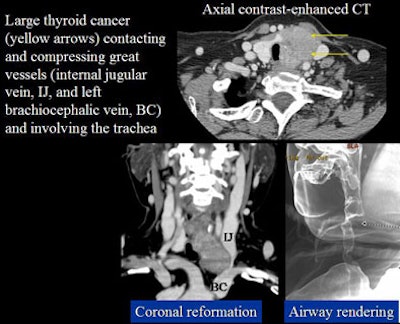 2005 11 14 00 40 34 706