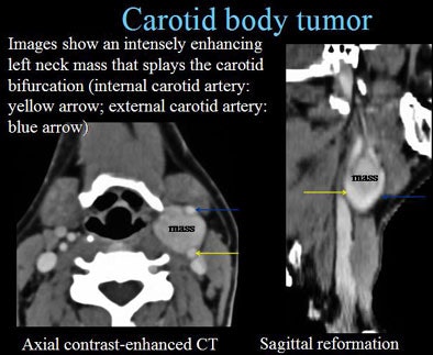2005 11 14 00 40 59 706