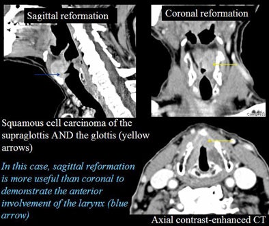 2005 11 14 00 41 16 706
