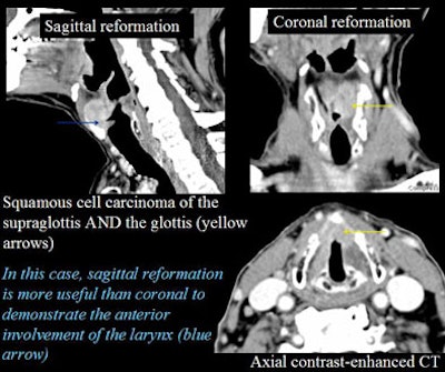 2005 11 14 00 41 16 706
