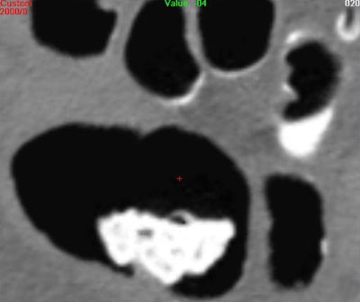 2005 11 15 17 38 16 706