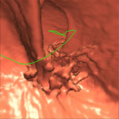 2005 11 15 17 38 35 706