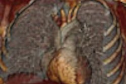 2005 11 18 13 55 44 706