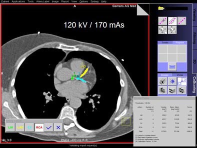 2005 11 18 14 19 33 706