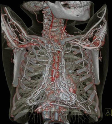 2005 11 18 14 26 33 706