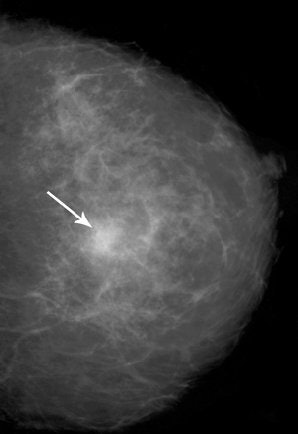 2005 11 28 00 09 57 706