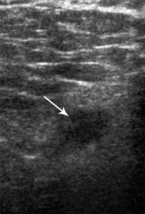 2005 11 28 00 10 12 706