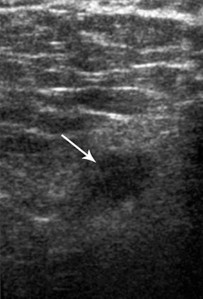 2005 11 28 00 10 12 706