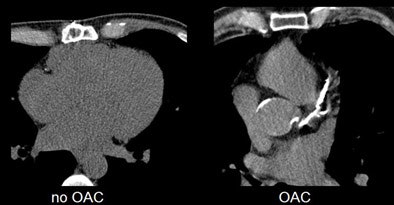 2005 12 02 16 37 03 706