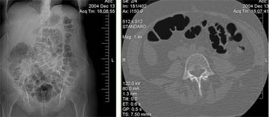 2005 12 13 14 33 18 706