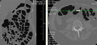 2005 12 13 14 33 35 706