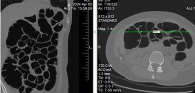 2005 12 13 14 34 17 706