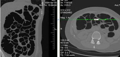 2005 12 13 14 34 17 706