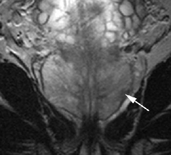 2005 12 14 15 53 15 706