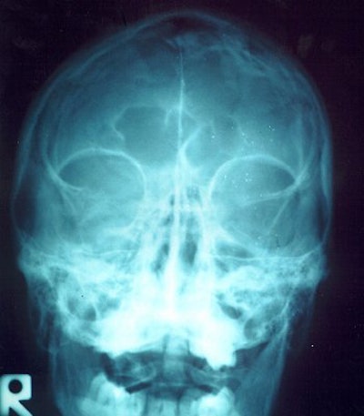 2005 12 26 11 17 39 706