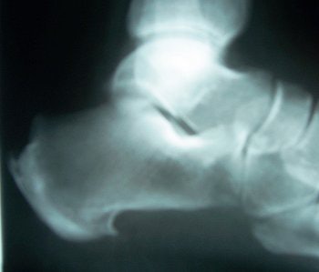 2005 12 26 11 18 03 706