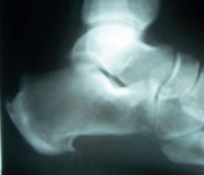 2005 12 26 11 18 03 706