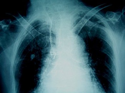 2005 12 26 11 18 51 706