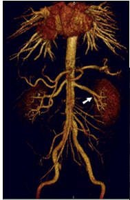 2006 01 13 13 50 18 706