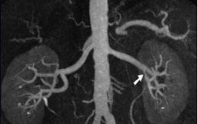 2006 01 13 13 50 31 706