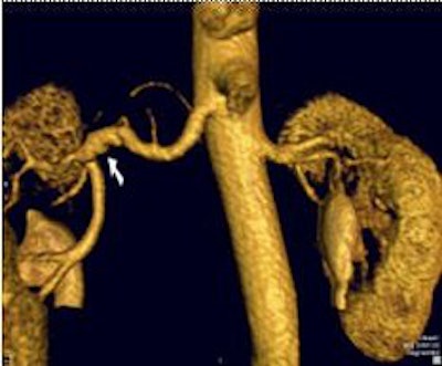 2006 01 13 13 50 51 706