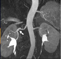 2006 01 13 13 51 11 706