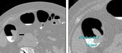 2006 01 20 17 09 56 706