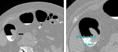 2006 01 20 17 09 56 706