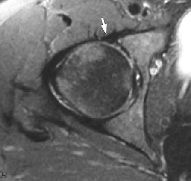 2006 01 23 15 56 06 706