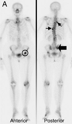 2006 01 25 15 52 34 706