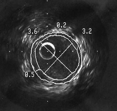 2006 02 21 15 14 46 706