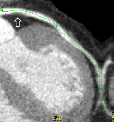 2006 02 22 09 45 28 706