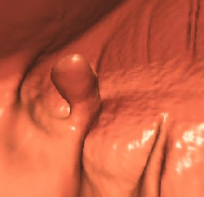 2006 02 28 15 26 42 706