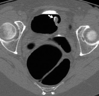 2006 02 28 15 27 00 706