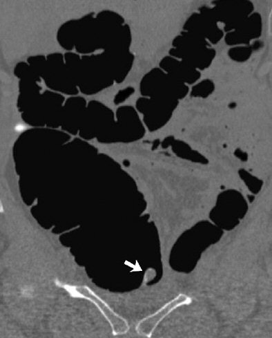 2006 02 28 15 27 16 706