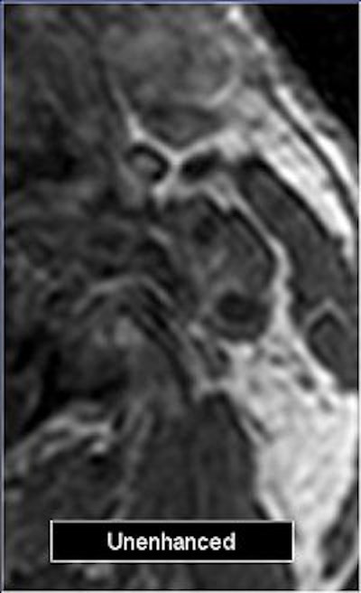 2006 03 03 15 09 36 706